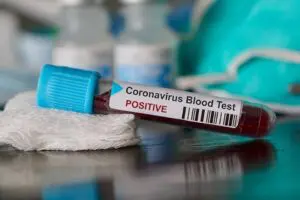 Sağlık Bakanlığı Corona vir&uuml;s&uuml; (koronavir&uuml;s) i&ccedil;in son gelişmeleri ve T&uuml;rkiye