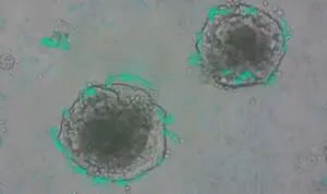 Bilim insanları, genetik mühendislikle kanser hücrelerini tespit etmek amacıyla özel