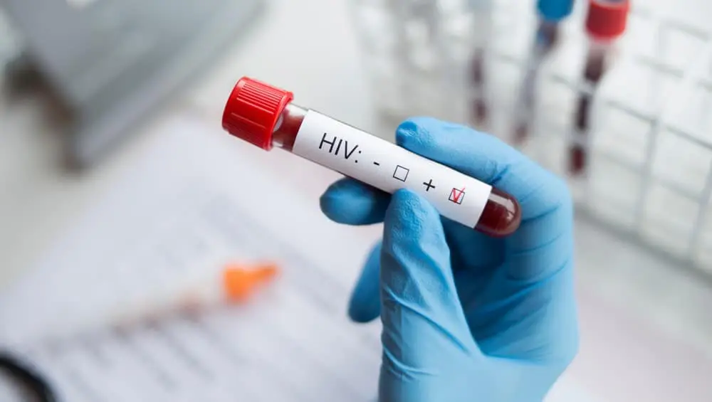 İzmir’de kemik erimesi şüphesiyle hastaneye yatırılan 13 yaşındaki çocuğun AIDS
