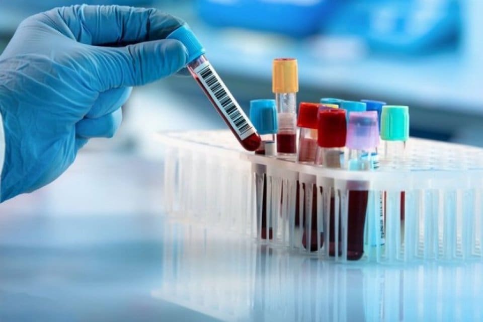 DS&Ouml;,&nbsp;11 &uuml;lkede g&ouml;r&uuml;len en az 169 hepatit vakasından bir kişinin
