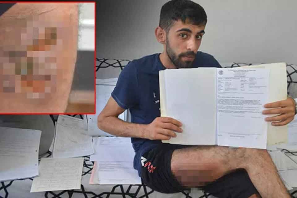 21 yaşındaki gen&ccedil;, 12 yıl &ouml;nce arkadaşıyla şakalaştığı esnada sağ