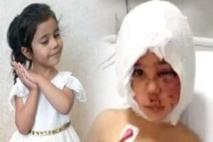 Gaziantep'te, Asiye Ateş'in (4) oturduğu sitenin bah&ccedil;esinde oyun oynarken pitbull