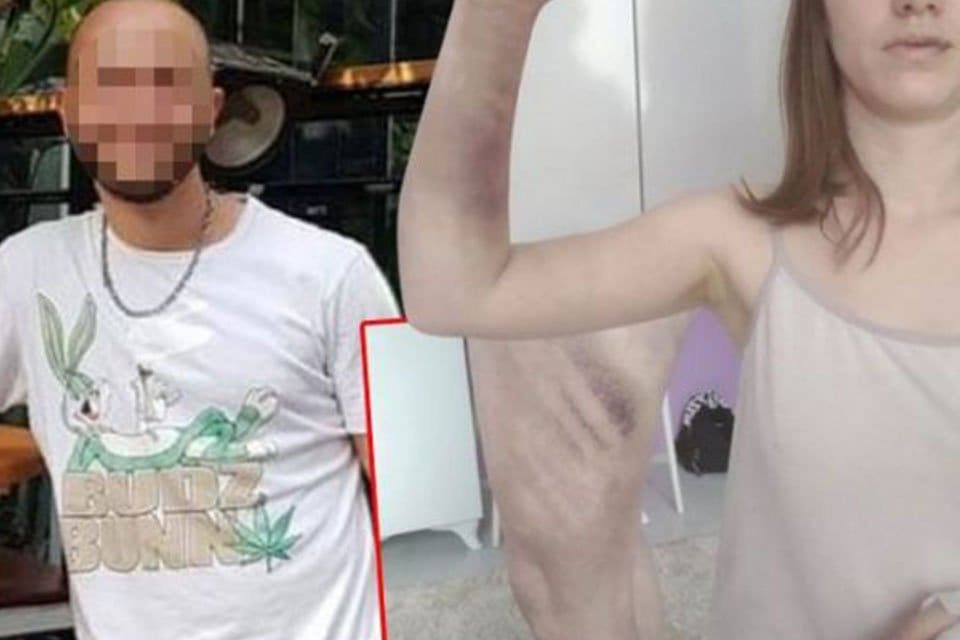 Kız arkadaşını beyzbol sopasıyla darp ettiği gerek&ccedil;esiyle yargılanan sanık, "silahla