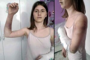 İzmir'in Karşıyaka il&ccedil;esinde, kız arkadaşı Zeynep &Ccedil;etinkaya'yı (26) beyzbol sopasıyla