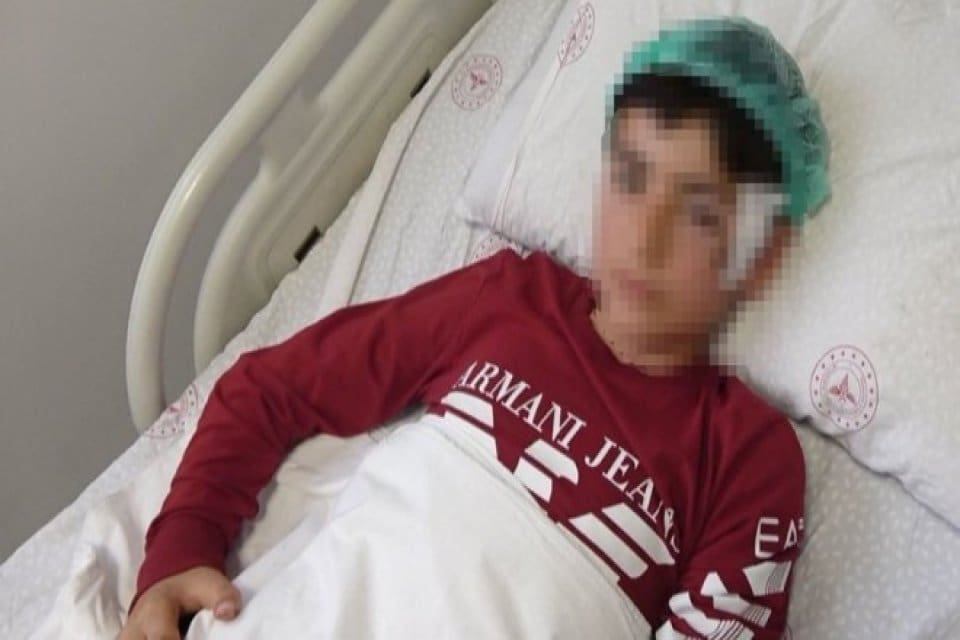 Aksaray'da koyun otlatan 12 yaşındaki &ccedil;ocuğa, sahipsiz olan Pitbull cinsi