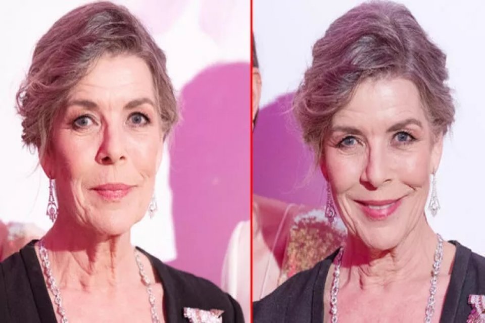 'S&uuml;rekli gen&ccedil; ve kusursuz g&ouml;r&uuml;nme' fikri sadece g&ouml;steri d&uuml;nyasının &uuml;nl&uuml;lerinin