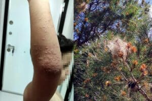İzmir'de ormanlık alanlarda g&ouml;r&uuml;len &ccedil;am kese b&ouml;cekleri, yaydığı zehirle tehlike