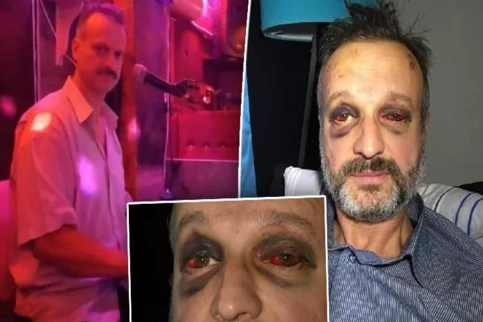 Bursa'da bir gece kul&uuml;b&uuml;nde sahneye &ccedil;ıkan m&uuml;zisyen &Ouml;zkan S&uuml;slerer&rsquo;i (44),