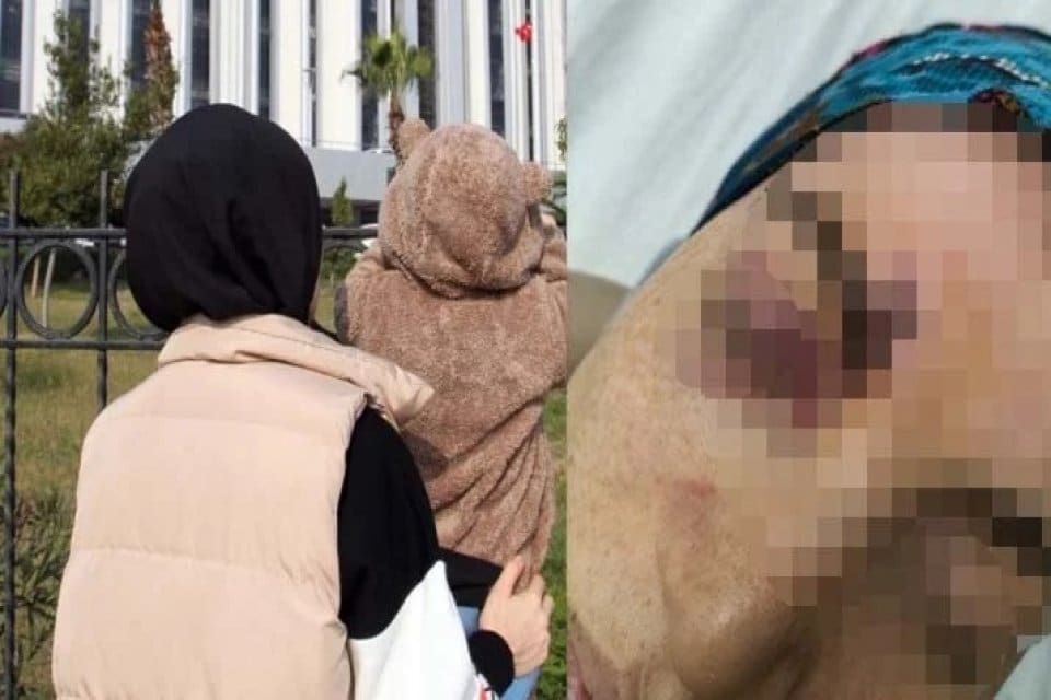Hatay'da, cinsel ilişki teklifini reddedince eşi M.K. tarafından d&ouml;v&uuml;len Hatice