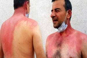 Edirne&rsquo;de Ercan Yılmaz'ın sigara dumanından rahatsız olduğunu belirttiği komşusu G&uuml;nd&uuml;z