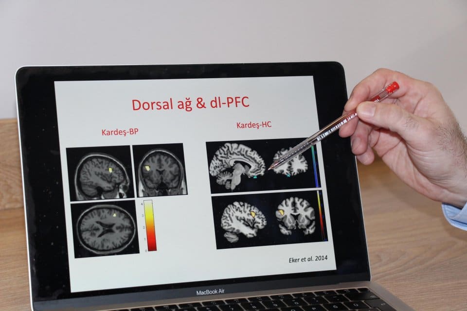 T&uuml;rkiye'de yaklaşık 50 kişide 1 g&ouml;r&uuml;len bipolar bozukluk hakkında bilgi