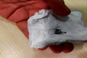 Bursa'da implant tedavisi için diş kliniğine giden kadının akciğerine implant