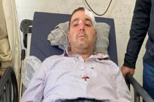 Sakarya'da, kendisini kontrol i&ccedil;in aile sağlığı merkezine &ccedil;ağıran aile hekimi