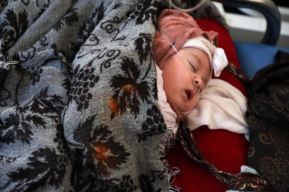 D&uuml;nya Sağlık &Ouml;rg&uuml;t&uuml; (DS&Ouml;), Yemen'de kızamık ve &ccedil;ocuk felci vakalarının