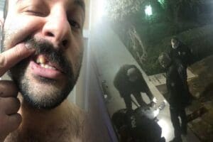 Antalya'da 5 polis memuru hakkında, bir site sakininin şikayet&ccedil;i olduğu