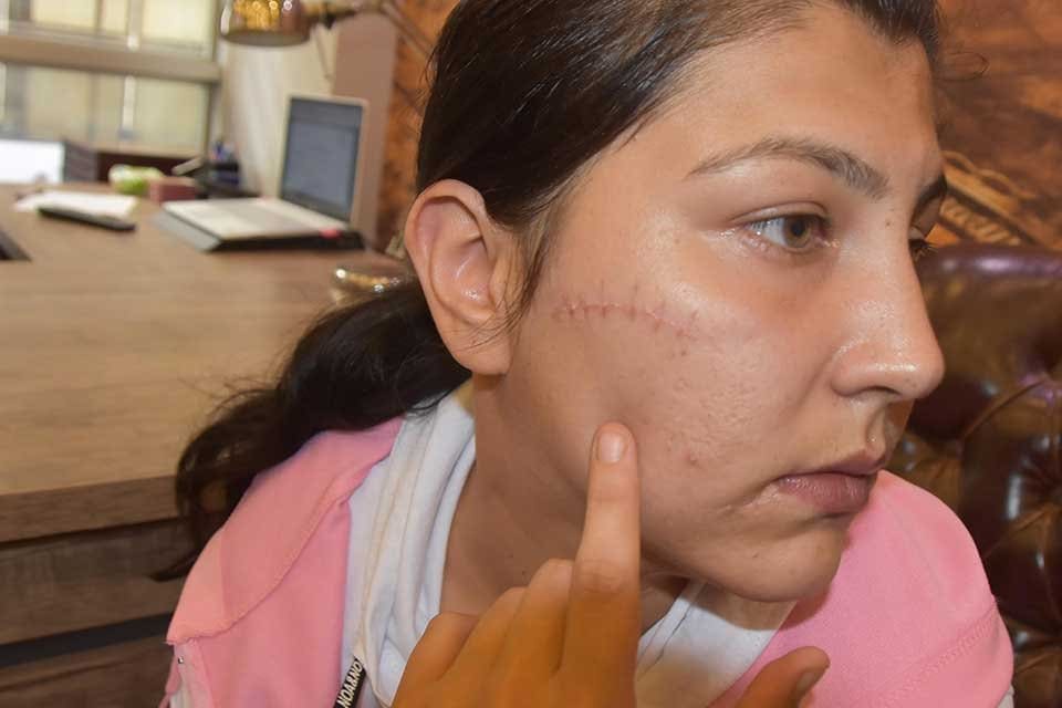 İzmir'in Buca il&ccedil;esinde, dini nikahlı yaşadığı Feyzi Duran (28) tarafından
