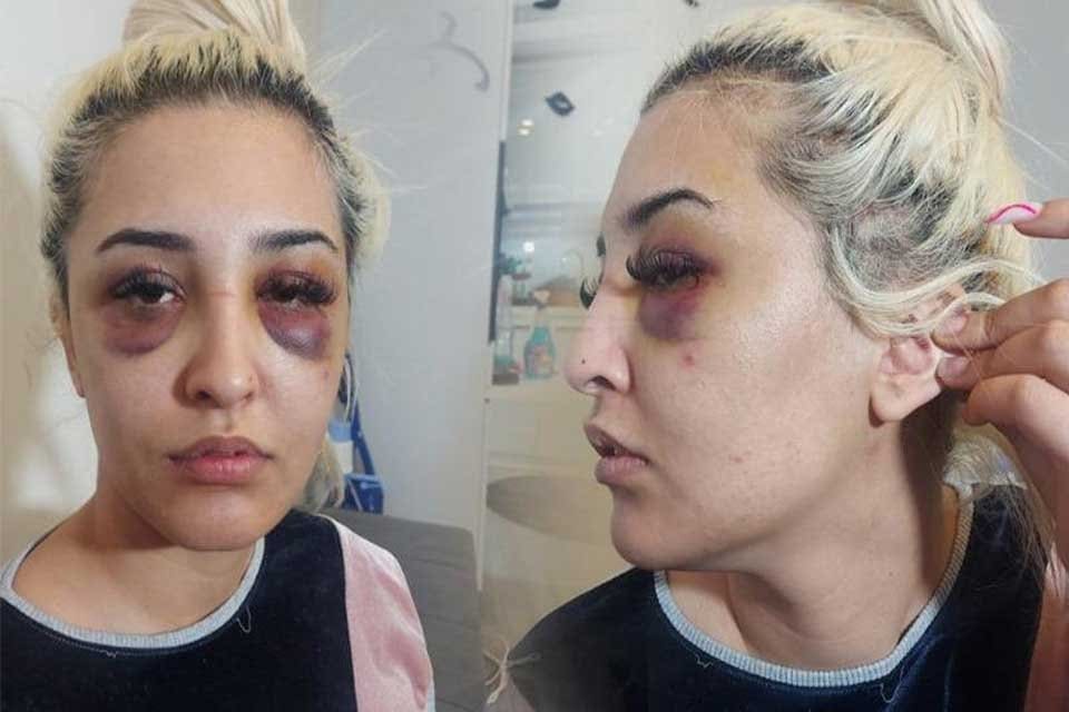 İZMİR'in &Ccedil;iğli il&ccedil;esinde yaşayan Gamze T&uuml;mt&uuml;rk (22), ayrılmayı kabul etmeyen