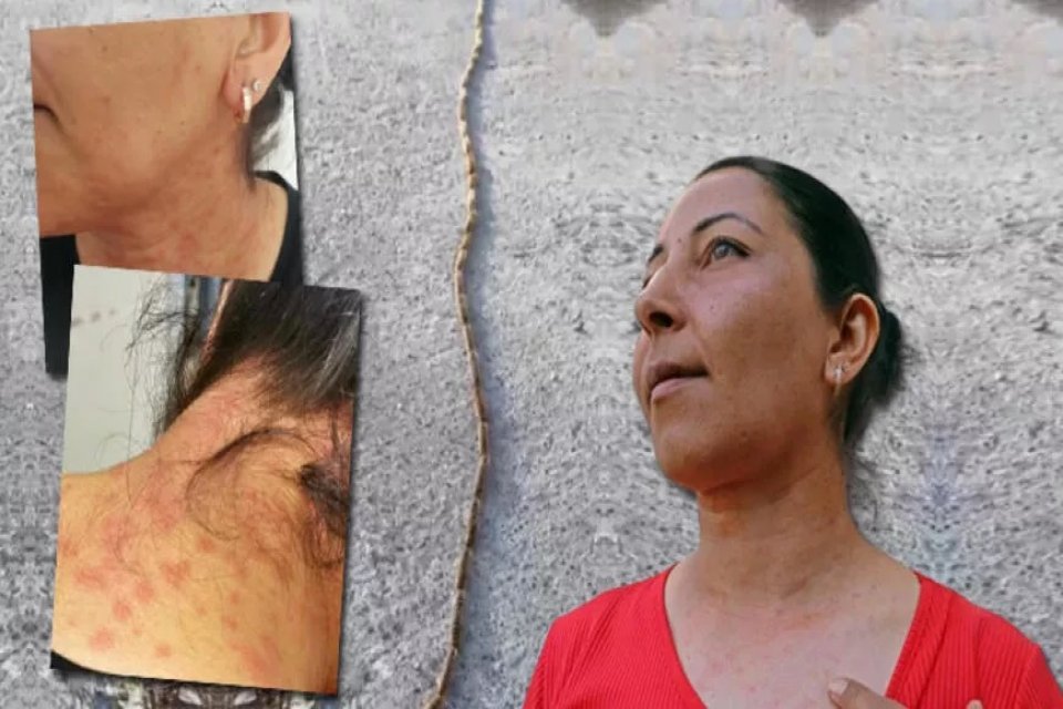 Antalya’da evinin bahçesinde kümeleşen onlarca çam kese tırtılını süpürgeyle süpüren