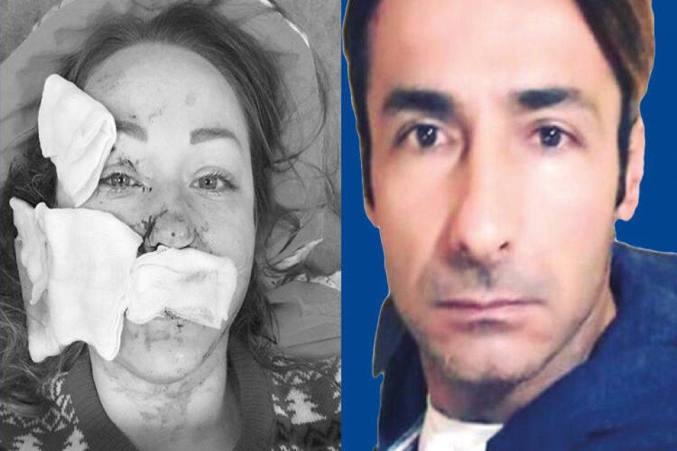 Kendisinden boşanmak isteyen Ukrayna uyruklu Hanna Butym’in yüzünü bir AVM’de