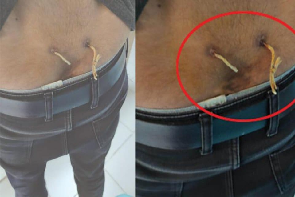 Doktor kontrol&uuml;nde yapılması gereken &lsquo;Geleneksel ve Tamamlayıcı Tıp Uygulamaları&rsquo; merdiven