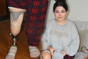 İzmir'de 1,5 yaşındayken menenjit mikrobunun kana karışması sonucu sağ bacağını