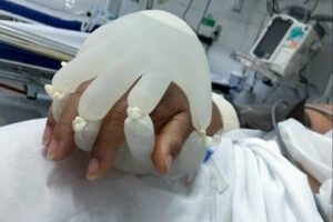 Salgının ruh sağlığına etkilerinin çokça konuşulduğu bugünlerde, Brezilya'da yoğun bakım