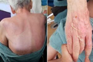 İZMİR'in G&uuml;zelbah&ccedil;e il&ccedil;esinde, yaşlı bakım evinde kalan Fatma Uraz (86),