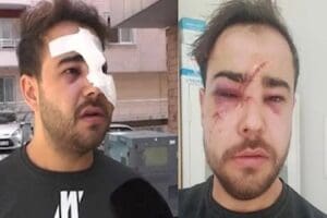 Hatay&rsquo;da sokak m&uuml;zisyenliği yapan Yusuf Karag&uuml;nd&uuml;z, i&ccedil;kili iki kişinin saldırısına