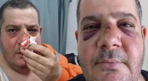 Hatay&rsquo;ın İskenderun il&ccedil;esinde, &ouml;zel temizlik şirketine bağlı &ccedil;alışan, sokakta g&ouml;revli