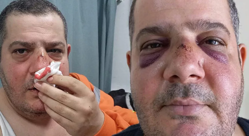 Hatay&rsquo;ın İskenderun il&ccedil;esinde, &ouml;zel temizlik şirketine bağlı &ccedil;alışan, sokakta g&ouml;revli