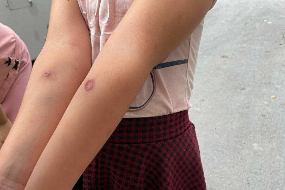 İstanbul Avcılar&rsquo;da mahalle sakinleri, yakında bulunan dere nedeniyle arttığını belirttikleri