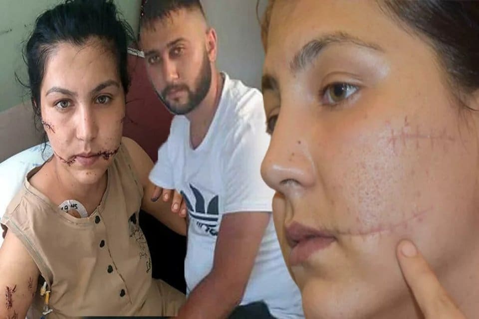 İzmir'in Buca il&ccedil;esinde, dini nikahla birlikte yaşadığı Aysel Perkg&uuml;n'&uuml; (28)
