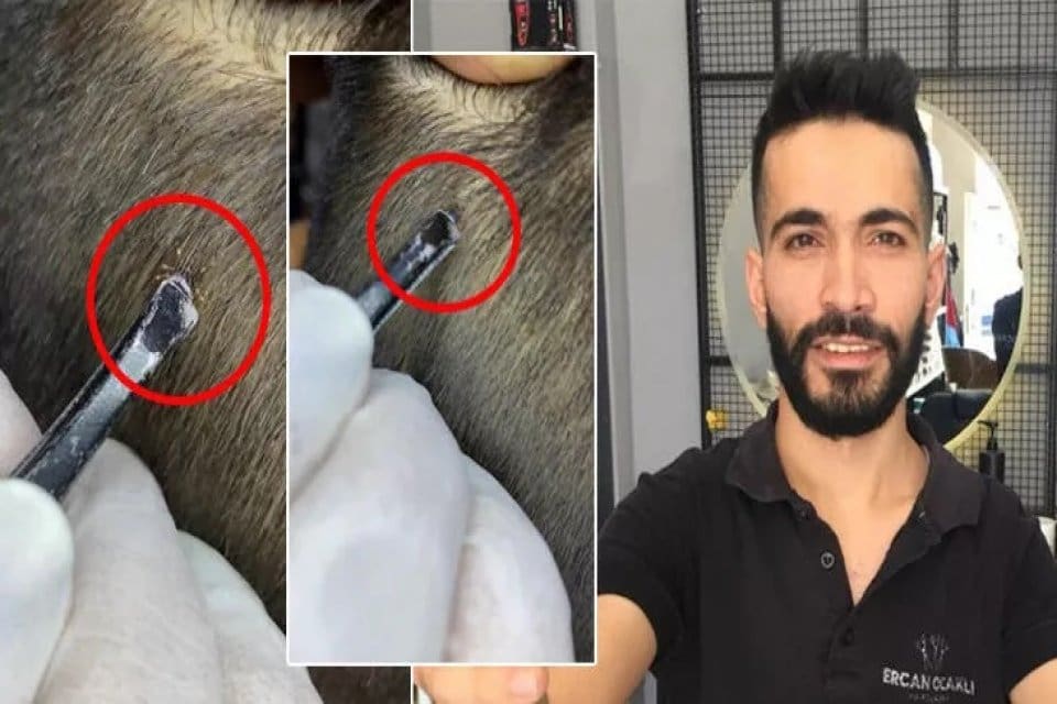 Adana&rsquo;da berbere sa&ccedil; tıraşı olmaya gelen bir kişinin kafasında tespit