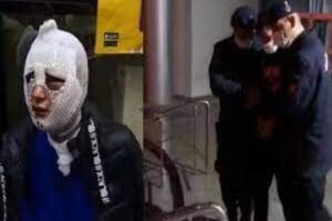 Hatay'da eski kız arkadaşının y&uuml;z&uuml;ne kızgın yağ d&ouml;kerek ağır yaralayan