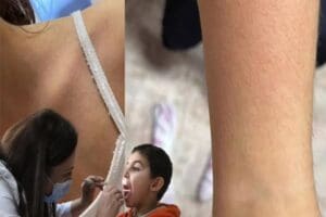 &Ccedil;ukurova &Uuml;niversitesi (&Ccedil;&Uuml;) Tıp Fak&uuml;ltesi Balcalı Hastanesi &Ccedil;ocuk Enfeksiyon Bilim