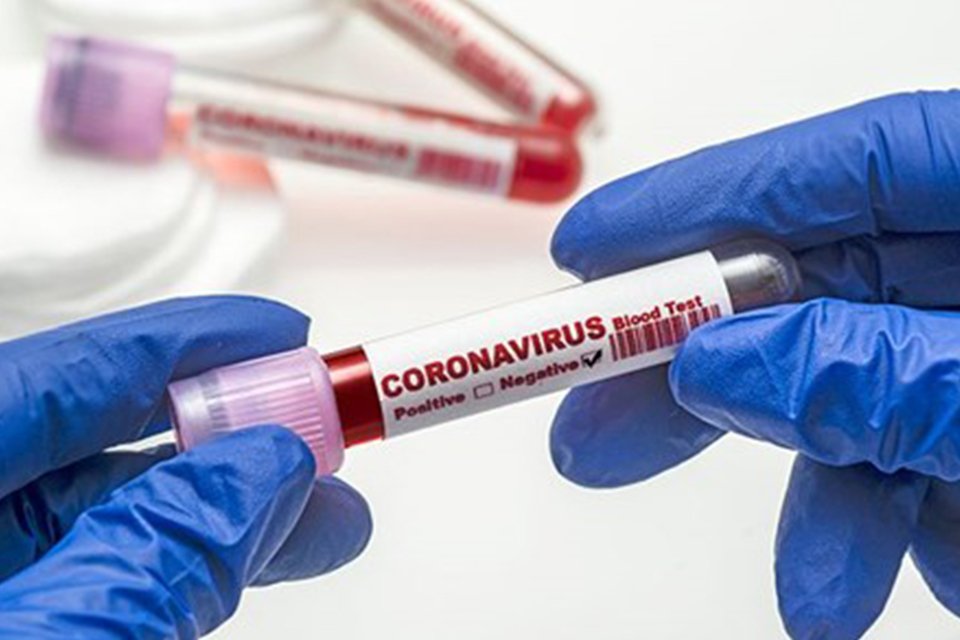 Sağlık Bakanlığı, corona virüsü salgını nedeniyle yaşanan yeni can kaybını,