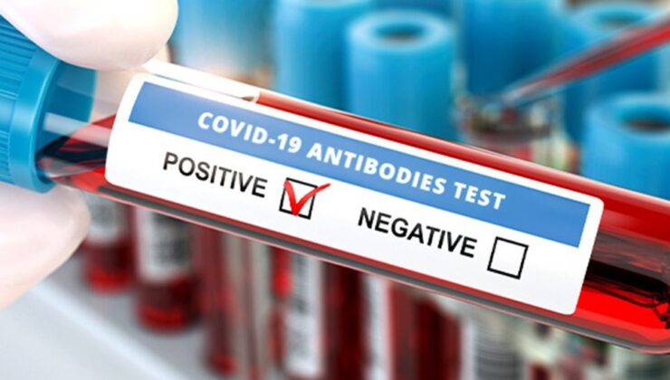 Koronavirüs verileri açıklandı: 110 can kaybı, 7 bin 901 yeni vaka