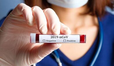 Koronavirüs verileri açıklandı: 112 can kaybı, 6 bin 670 yeni vaka