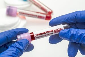 Sağlık Bakanlığı Corona virüsü (koronavirüs) için son gelişmeleri ve Türkiye