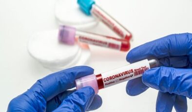 Koronavirüs verileri açıklandı: 124 can kaybı, 7 bin 719 yeni vaka