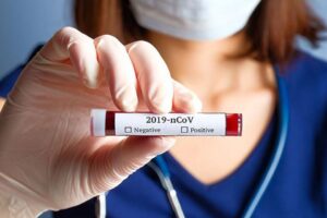 Sağlık Bakanlığı'nın açıkladığı 31 Ocak Pazar gününün korona tablosuna göre