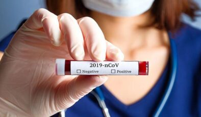 Koronavirüs verileri açıklandı: 129 can kaybı, 6 bin 871 yeni vaka
