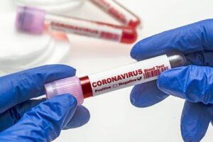 Sağlık Bakanlığı, koronavirüs tablosunu açıkladı. Tabloda, ağır hasta sayısında düşüşün