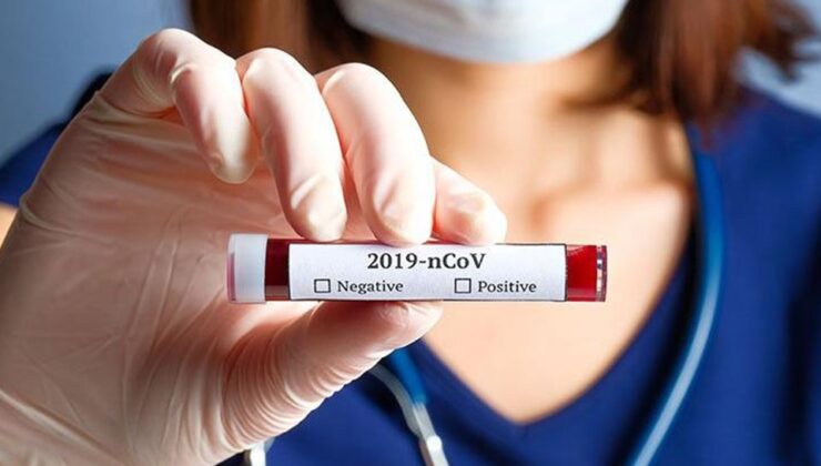 Koronavirüs verileri açıklandı: 140 can kaybı, 5 bin 277 yeni vaka