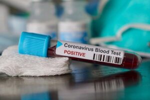 Sağlık Bakanlığı, Türkiye günlük koronavirüs tablosunu açıkladı. Tabloda, vaka sayısının