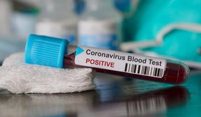 Koronavirüs verileri açıklandı: 149 can kaybı, 5 bin 967 yeni vaka