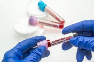 Sağlık Bakanlığı 25 Mart 2021 günlük corona virüs tablosunu açıkladı. Son 24