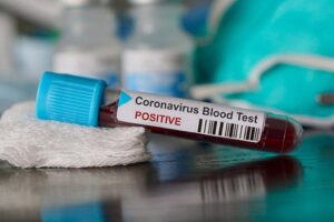 Sağlık Bakanlığı Türkiye Günlük Korona Tablosu'nu açıkladı. Tabloda iyileşen sayısının,