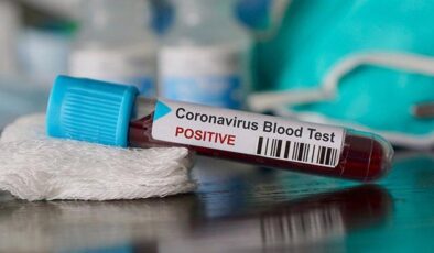 Koronavirüs verileri açıklandı: 174 can kaybı, 10 bin 220 yeni vaka
