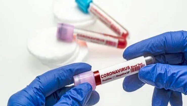 Koronavirüs verileri açıklandı: 175 can kaybı, 27 bin 592 yeni vaka